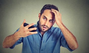 Symptoms of Hairloss