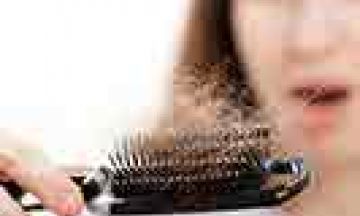 Baldness Nightmare: Even Females Get It! Are You One Of Them?