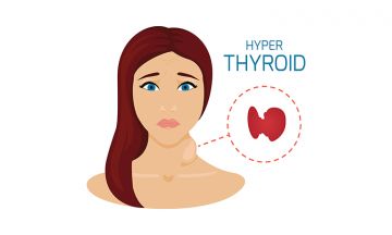 Benefits of Homoeopathy for Hyperthyroid