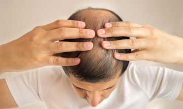 Benefits of Homeopathy in Healing Hair Loss | Dr Batra's™