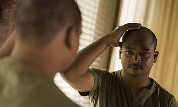 Hair Loss Treatments for Men
