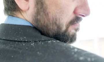 Dandruff Myths: True or False? Read on…