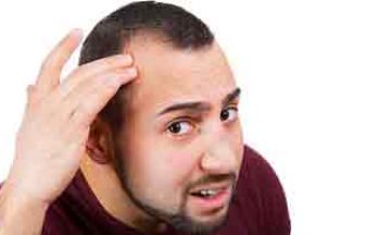 Why is my Hairline Receding?