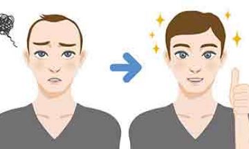 Answers for Hair-Transplant Queries…