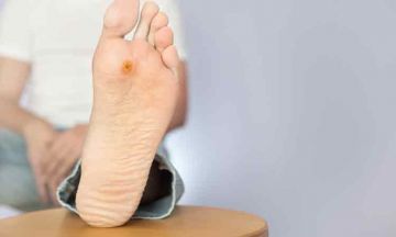 Prevention of Diabetic Foot Ulcer