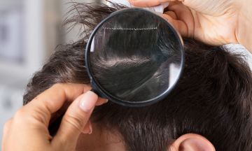 Advanced hair loss solutions for all your hair problems