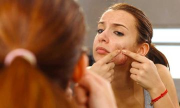 How to get rid of acne forever