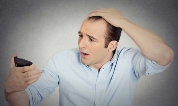 What can you do about male patterned baldness?