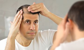 Genetic hair loss in males can be treated