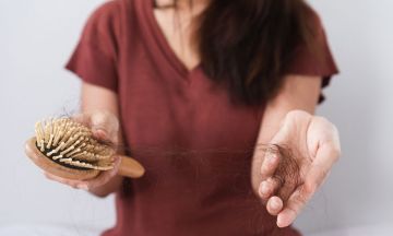 Losing your hair? No problem. It's not forever.	