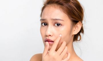 Zip the zit or treat it?