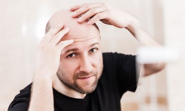 Hair loss runs in my family. Is there any way I can prevent it?
