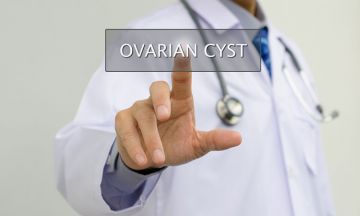 Ovary Cyst and Hair loss – What’s the link?