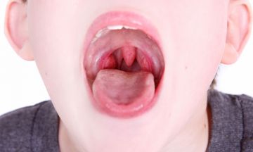 SWOLLEN TONSILS CHECK YOUR SIGNS AND SYMPTOMS