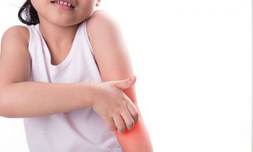 The impact of skin eczema on your child and on the family