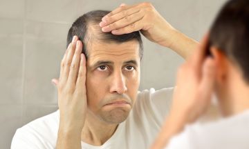 Know the 'Whys' of Male Pattern Baldness!