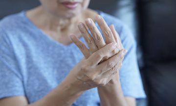Reasons why arthritis treatment in homeopathy is the best
