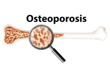 HOMEOPATHY & OSTEOPOROSIS