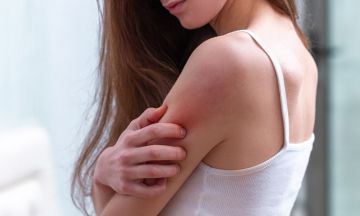 Get rid of your skin problems with homeopathy