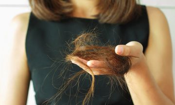 Things to do to stop your hair from falling out | Dr Batra's™