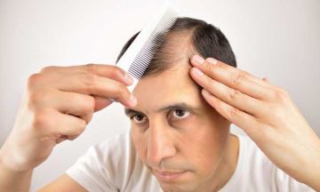HOMEOPATHIC GUIDE TO HAIR LOSS