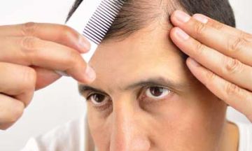 HOMEOPATHIC GUIDE TO HAIR LOSS