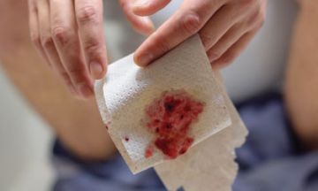 Avoid these mistakes if you have piles