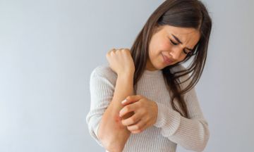 Itching to deal with psoriasis? Try homeopathy