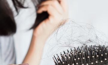 Top 5 Reasons for Female Pattern Baldness