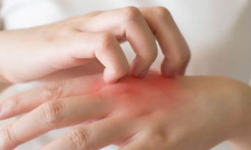 Suffering from allergies? Homeopathy can help