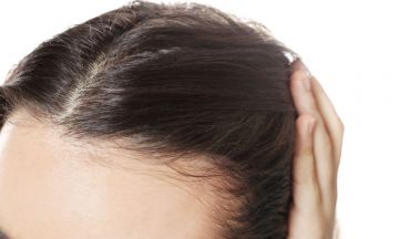 Myths about hair loss in women | Dr Batra's™