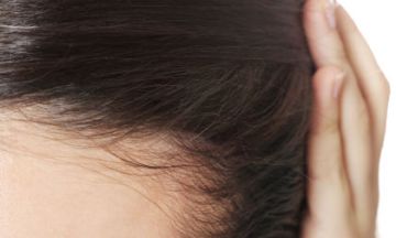 Myths about hair loss in women