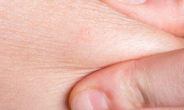 Tips to take care of your dry skin