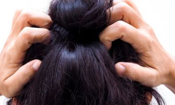 Scalp Psoriasis vs. Dandruff
