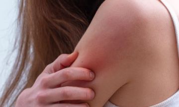 Clear eczema with homeopathy