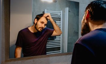 How to know if you have male pattern baldness?