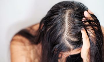Hairstyles for female pattern hair loss
