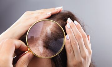 Say goodbye to hair problems this monsoon with homeopathy