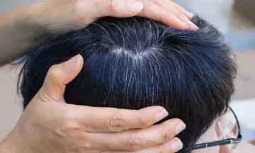 Should You Worry If Your Child Has Grey Hair? Should You Worry If Your Child Has Grey Hair?