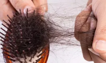 Advantages of seeking hair fall treatment in homeopathy