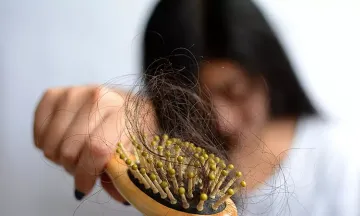 Allopathy vs. homeopathy: Which is the best hair fall treatment?