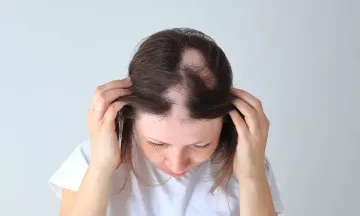 Should You Worry If Your Child Has Grey Hair? Should You Worry If Your Child Has Grey Hair?