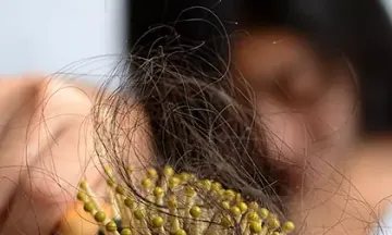 Factors responsible for hair fall in women