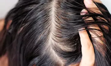 Hairstyles for female pattern hair loss