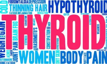 Hypothyroid almost balded me…