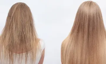Homeopathy stops hair loss and restores self-worth