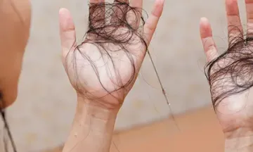 Homeopathy treats hair loss in women from the 'root'