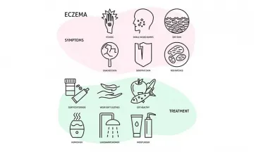 Is eczema merely a 'khujli'?