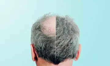 Should You Worry If Your Child Has Grey Hair?