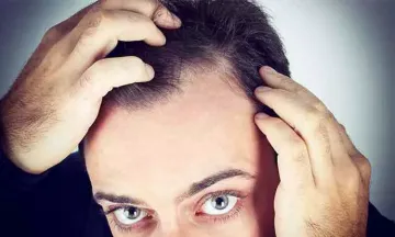 Mesotherapy for Hair Loss and Hair Growth